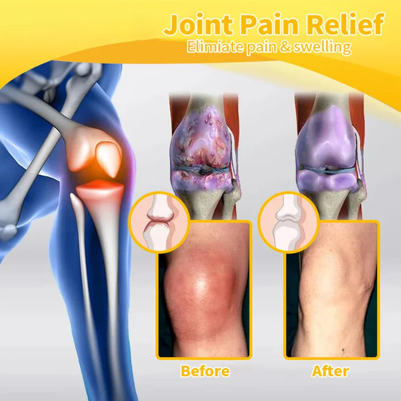 Bee-Venom Pain-Relief Bone Healing Cream (Buy 1 Get 1 Free)